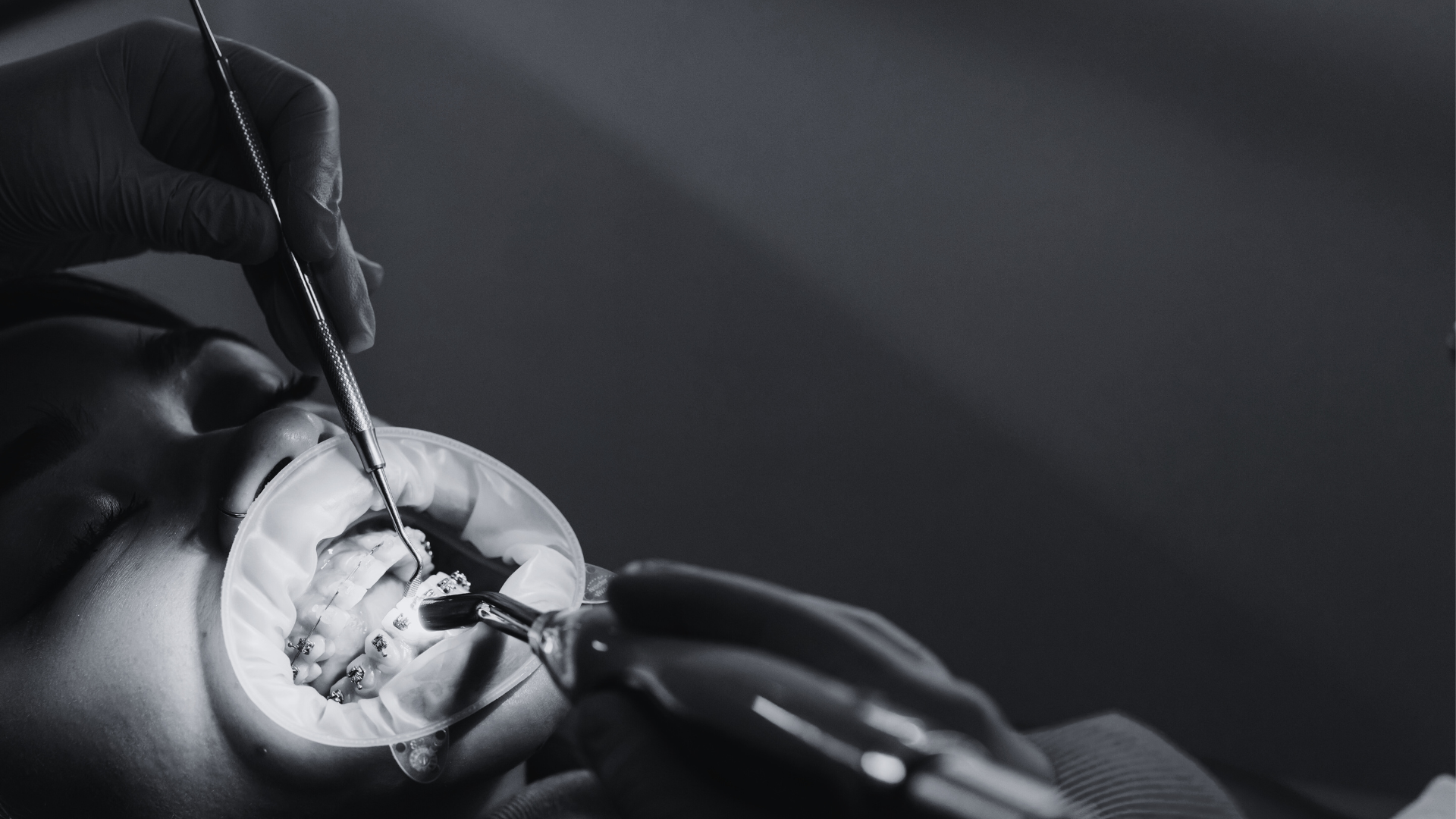 جراحة الاوعية الدموية دكتور احمد فؤاد